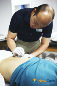 How Effective Is Physical Therapy Dry Needling With Electrical Stimulation?  - Mend Colorado